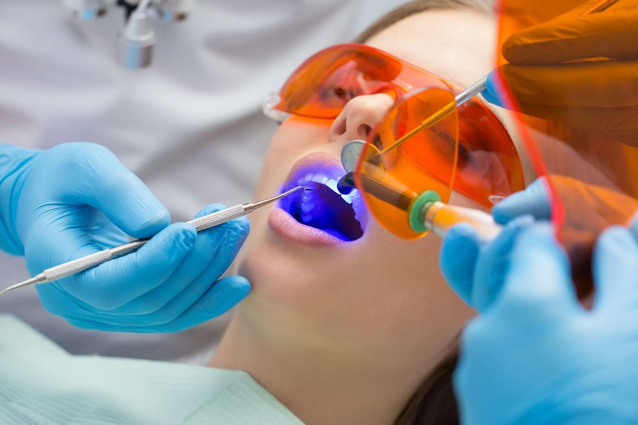 Zahnbehandlung in Polen - Zahnfüllung